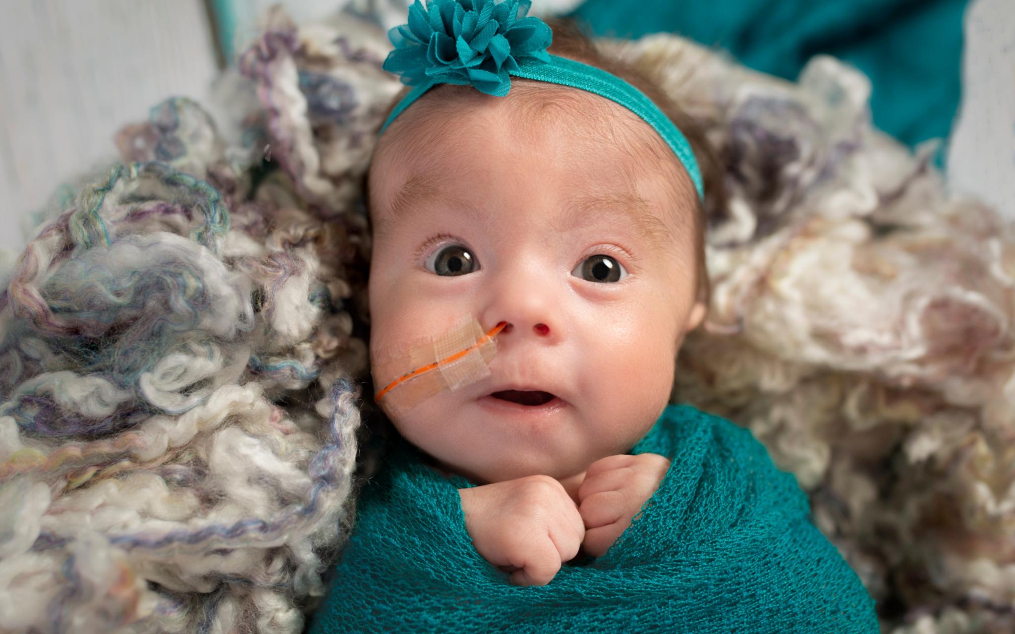 Baby mit Schlauch mit Luft zum Atmen in der Nase